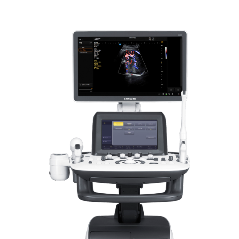Ultrasound systems
